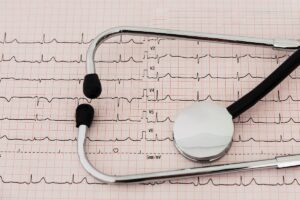 Stethoscope and EKG chart